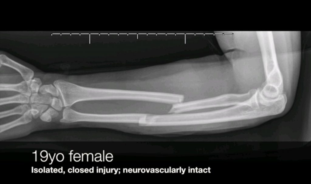 Hand & Upper Extremity Surgery - Orthopaedics SA